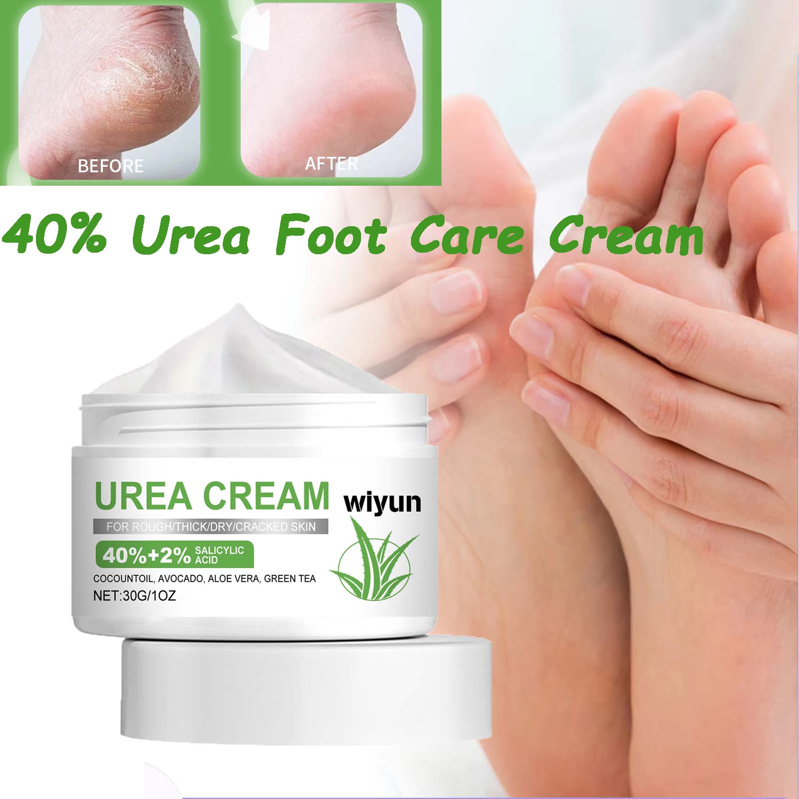 40% Urea Foot Care Cream Overn – Urea Foot Cream recenzja i cena