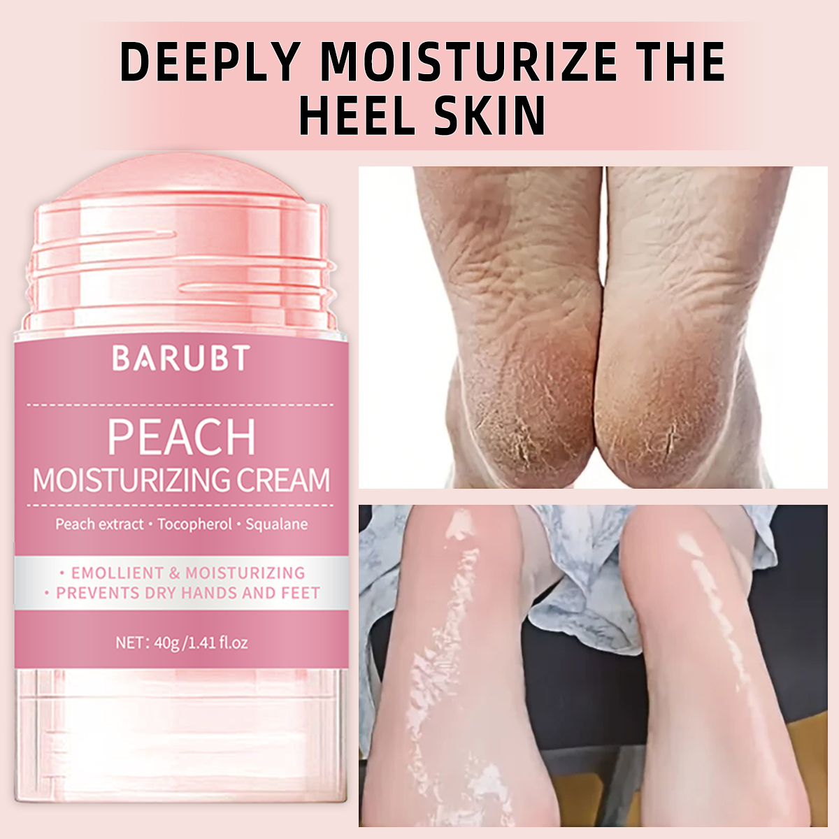 Peach urea mud film rod, salic – Urea Foot Cream recenzja i cena