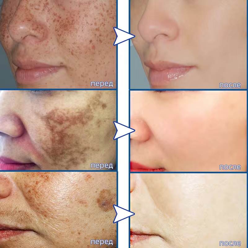Powerful Spot-removing Whiteni – Skincare Vitamin C recenzja i cena