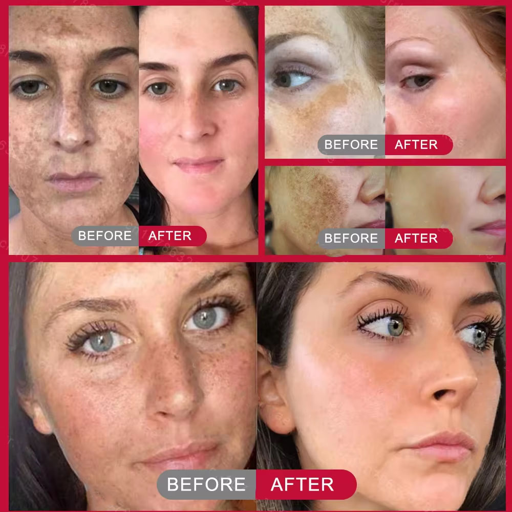Powerful Spot-removing Whiteni – Skincare Vitamin C recenzja i cena