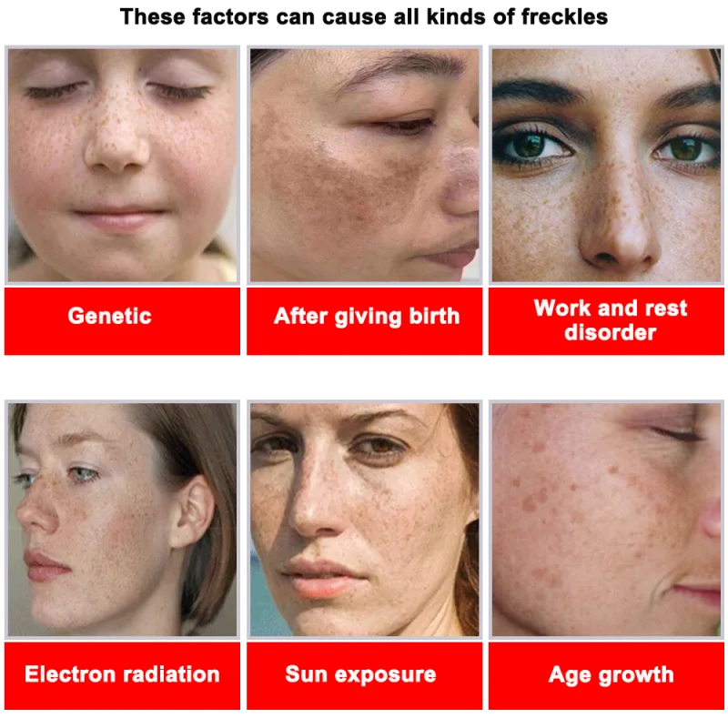 Powerful Spot-removing Whiteni – Skincare Vitamin C recenzja i cena