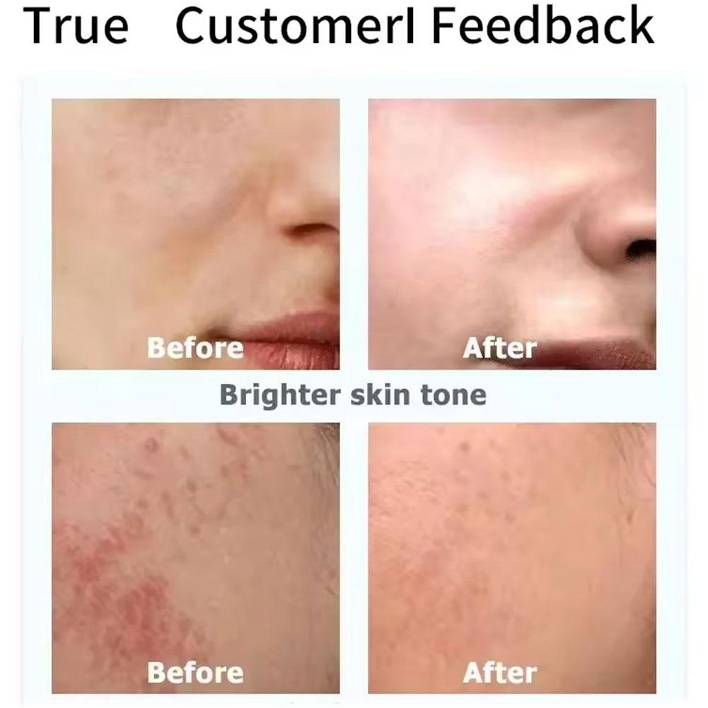 Kojic Acid Face Cream Lotion G – Skincare Vitamin C recenzja i cena