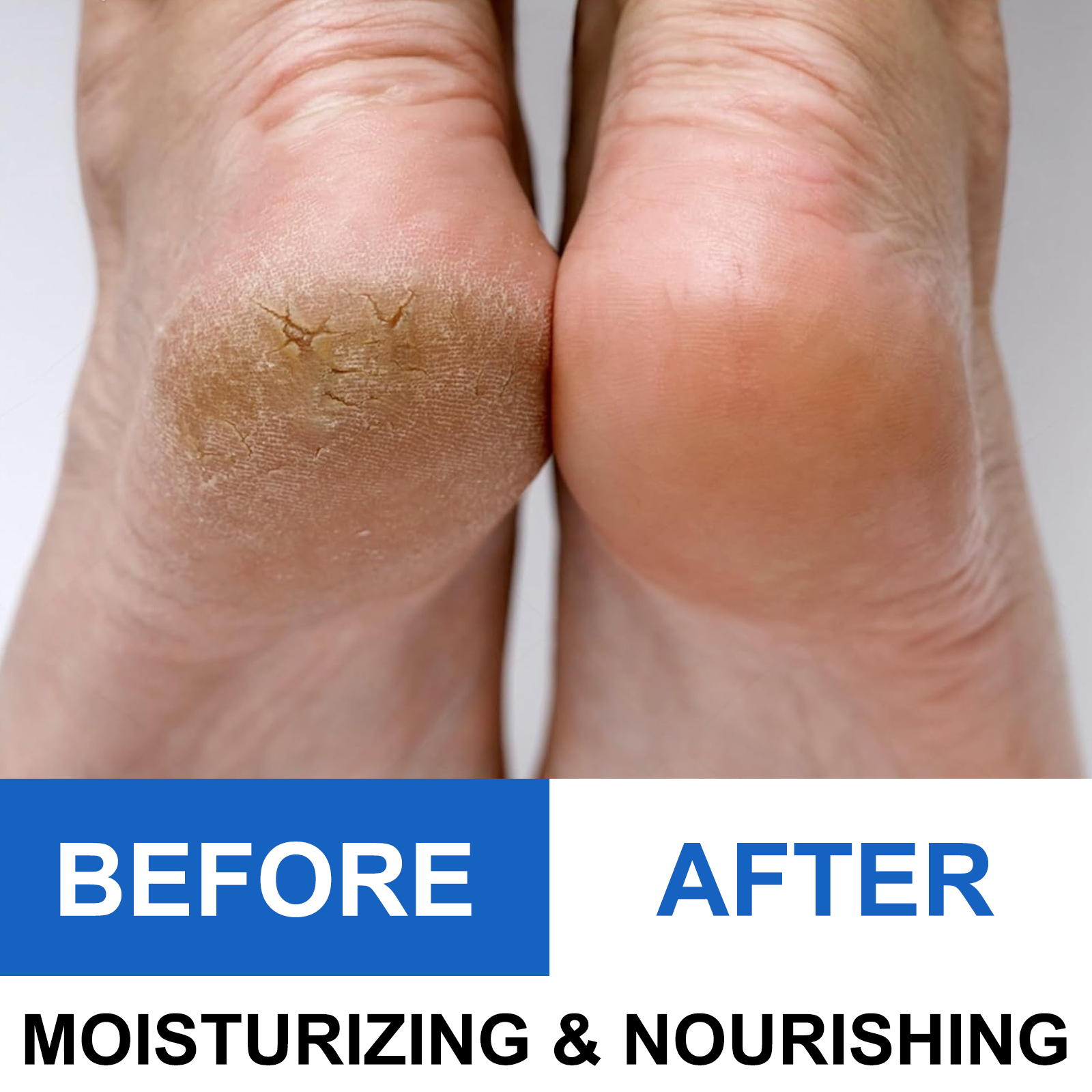 40% Urea Foot Cream Stick - Mo – Urea Foot Cream recenzja i cena