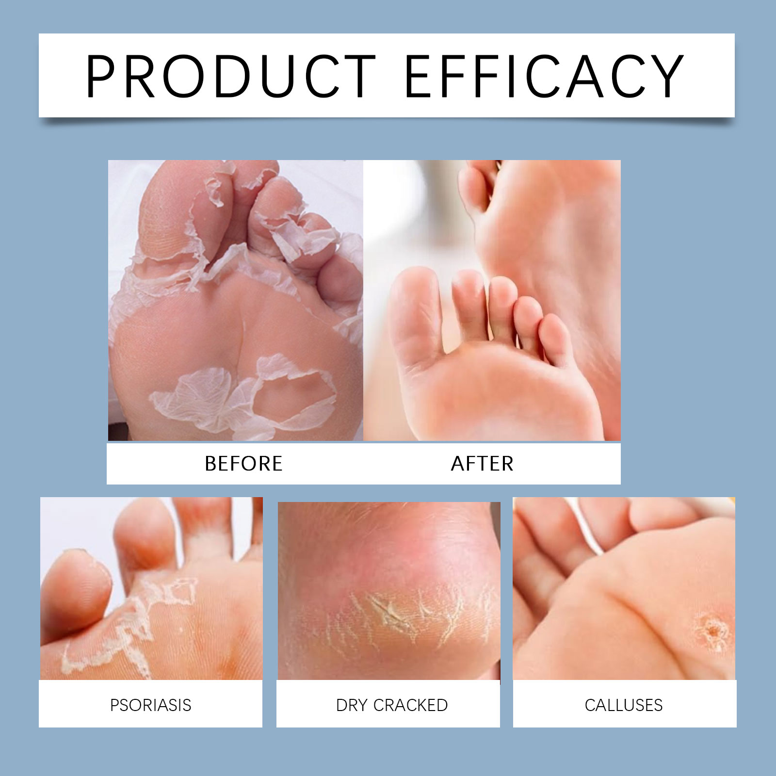 60% Urea Foot Cream Stick Mois – Urea Foot Cream recenzja i cena